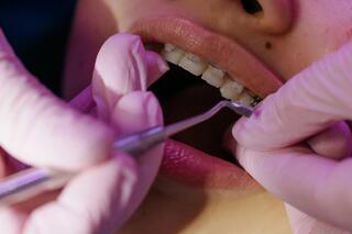 Lump on the Gum