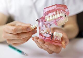 Contraindications for Dental Implantation