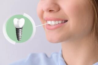 Dental Prosthetics