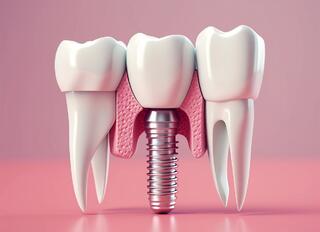 Implant Rejection