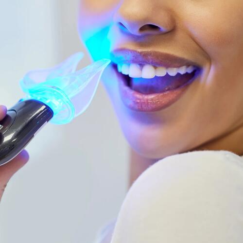 Teeth Whitening