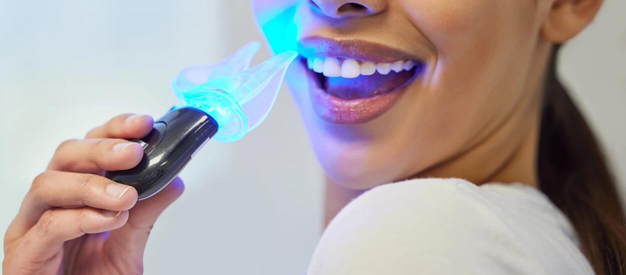 Teeth Whitening