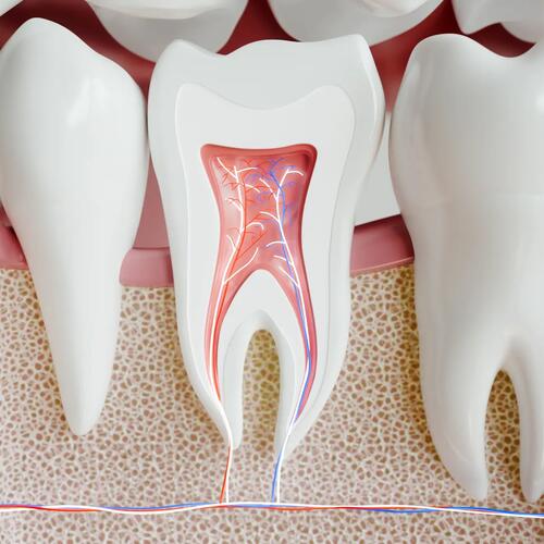 Tooth Nerve Removal