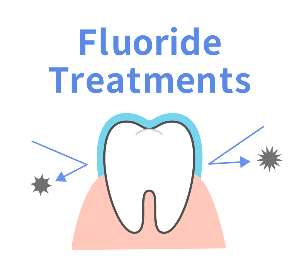 Fluoridation of Teeth